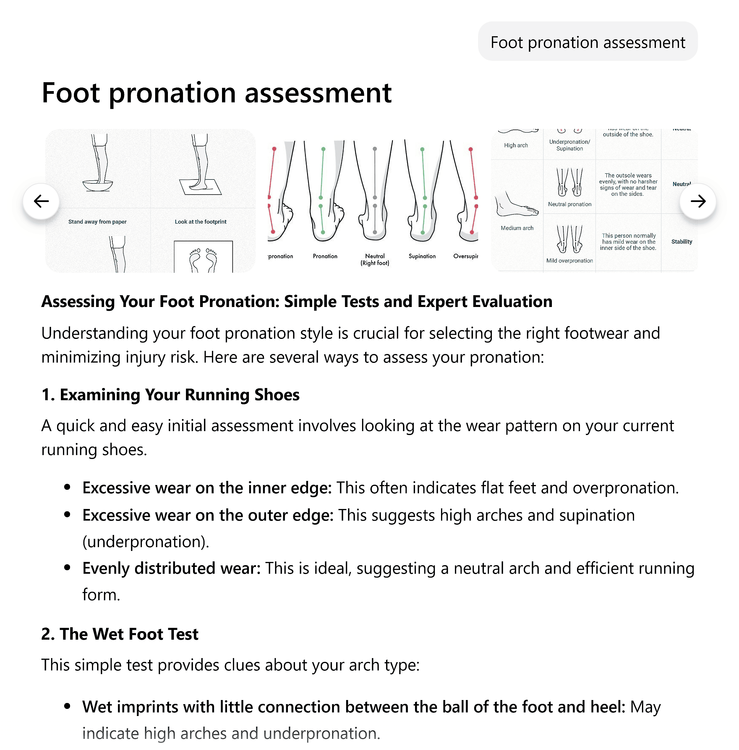 Sigma Chat – Foot pronation Sigma Chat – Foot pronation